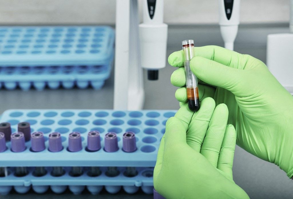 Ukrajna a háború miatt világ leghatásosabb antibiotikumainak ellenálló baktériumok tenyészhelyévé vált